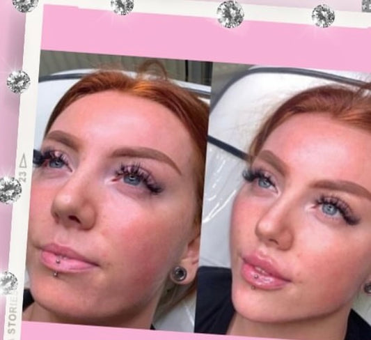 Facial balancing training